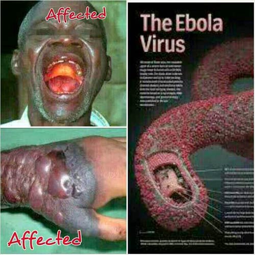 Cách phòng ngừa EBOLA